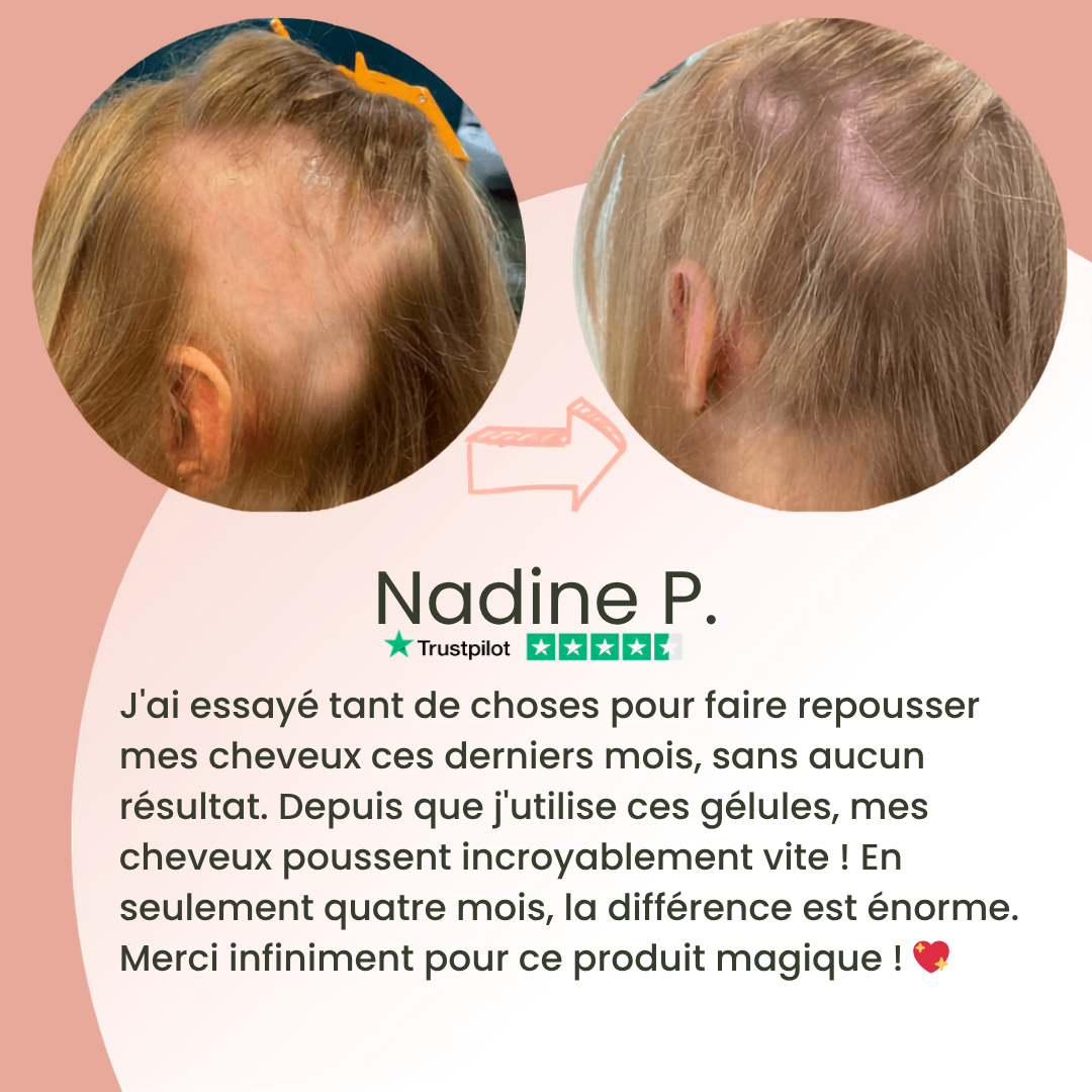 Gélules à l’huile de graines de courge – Cheveux forts & densité naturelle