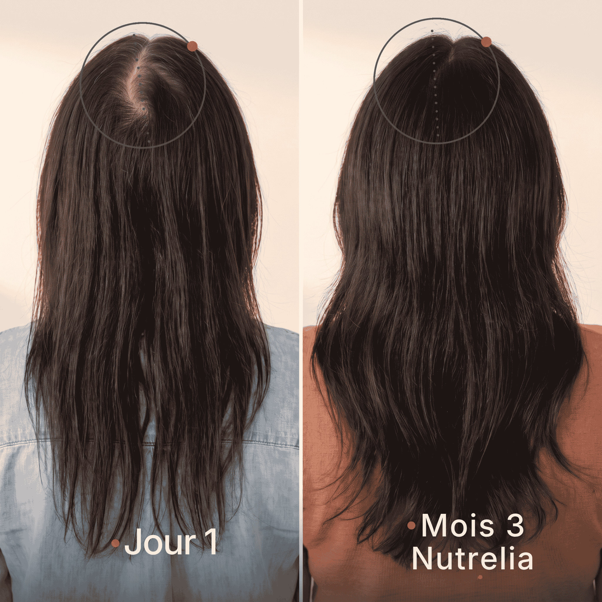 Gélules à l’huile de graines de courge
